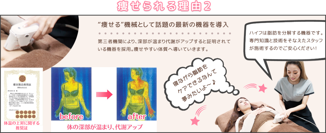 選ばれる理由2